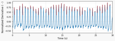 pulse-monitor-derivative-trace