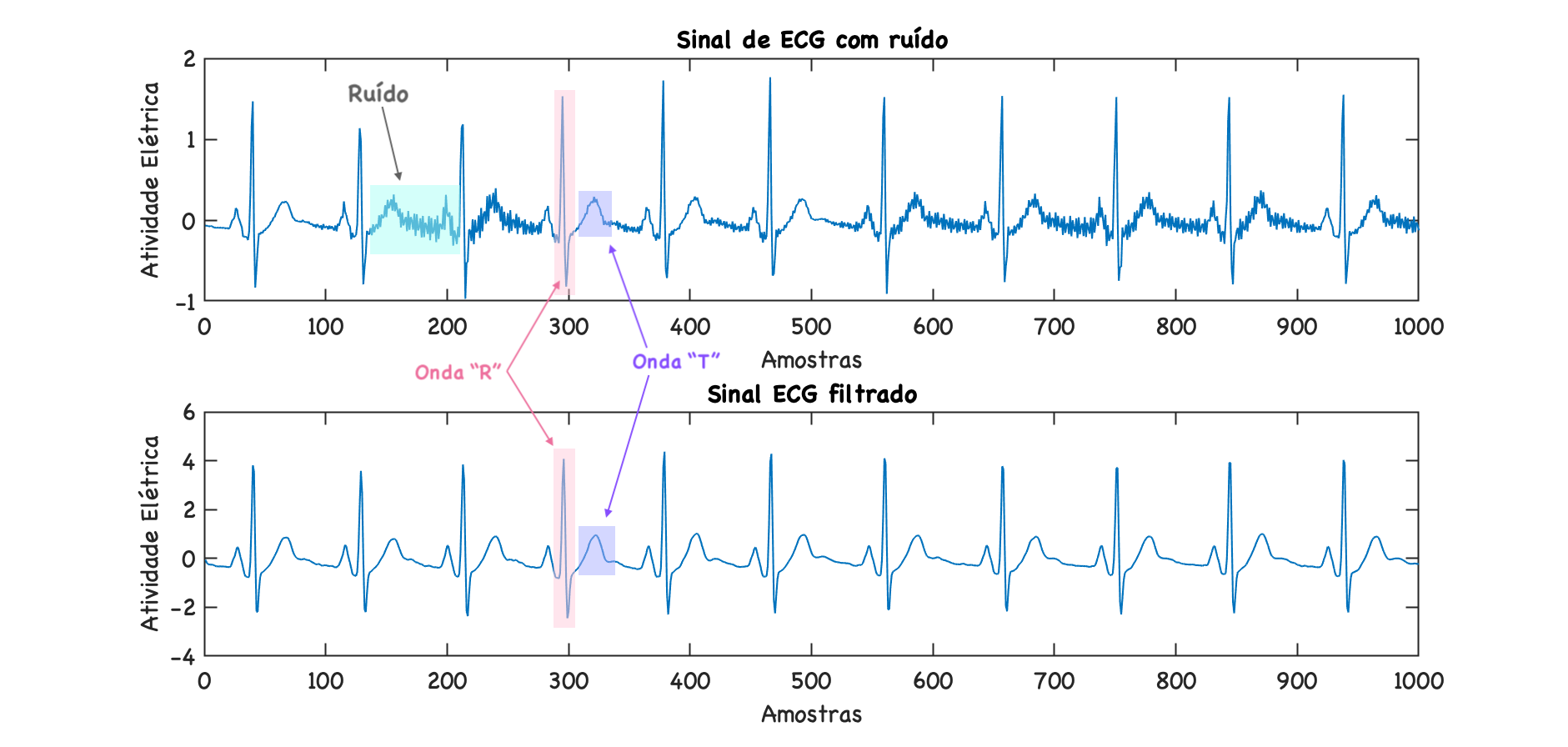 filtro_notch_sinal_ECG