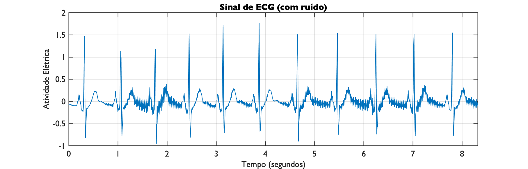 noisy_ecg_1000.png