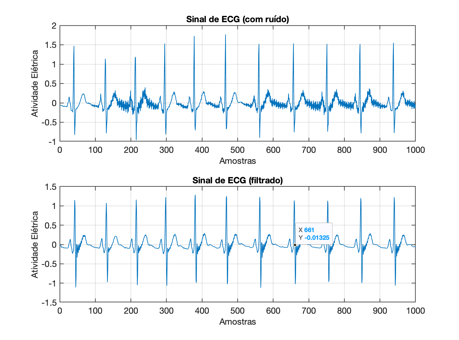 sinal_ECG_butter_low_42Hz_15a.png