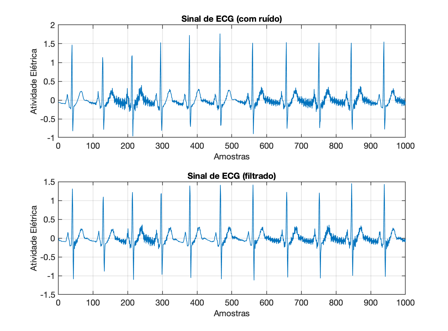 sinal_ECG_butter_low_50Hz_15a.png