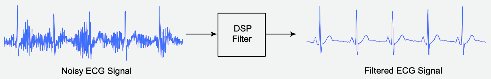 sinal_ECG_filtrar